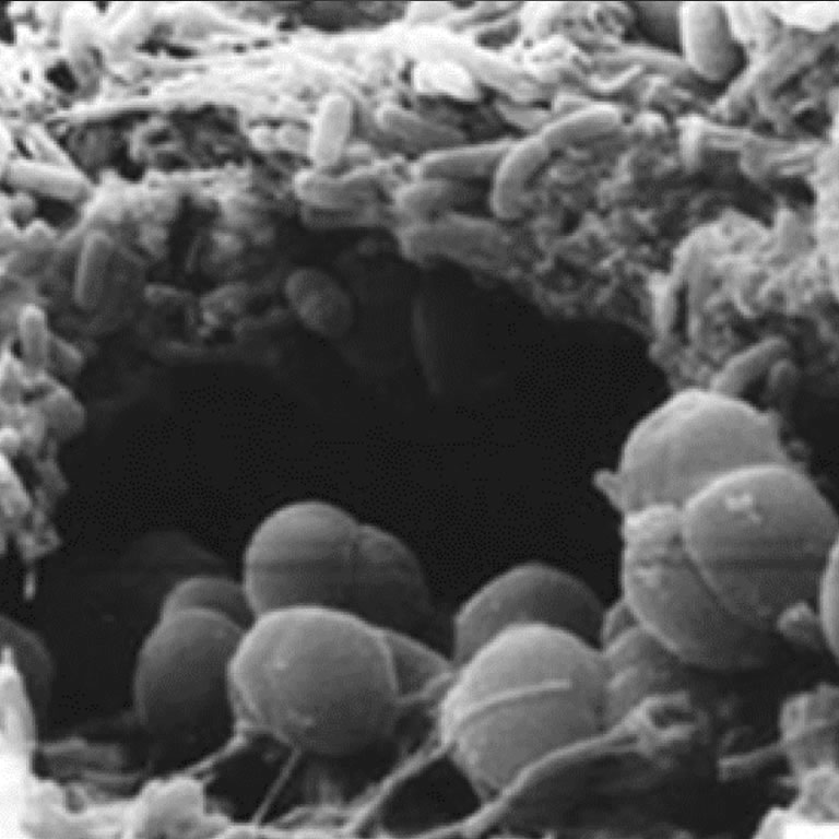 Biofilms en Endodoncia